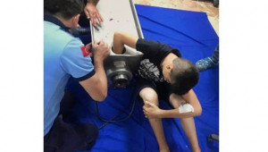 Babasına Yardım Ederken Elini Kıyma Makinesine Kaptırdı