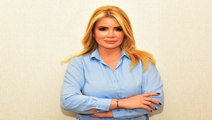 Saç dökülmesi erkekleri daha yaşlı gösteriyor