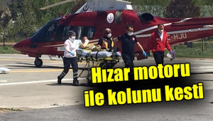 Odun kesmek isterken kolunu kesti