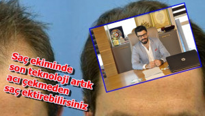 Saç ekimi hakın'da bilmediklerimiz