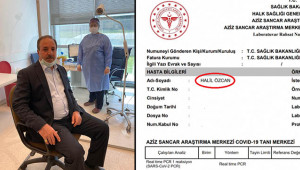 Vekil Özcan’ın korona test sonucu açıklandı
