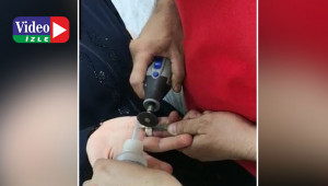 Kadının parmağındaki yüzük bakın nasıl çıkarıldı