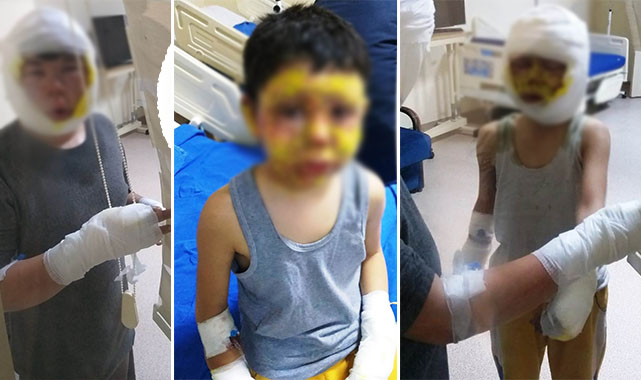 Mazot tenekesi bomba gibi patladı! 4 çocuk yaralandı