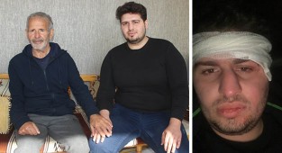 Ukrayna’da yaralanan Urfalı öğrenci yaşadıklarını anlattı