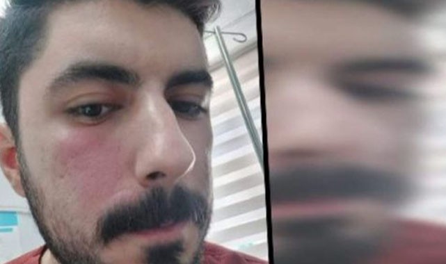2 sağlıkçıyı darp eden şahıs tutuklandı!