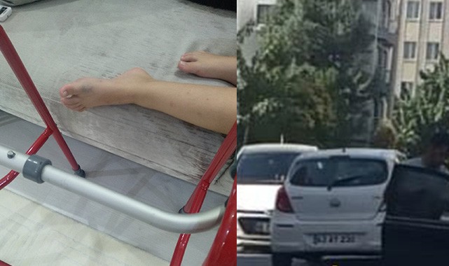 Önce çarptı arkasına bakmadan kaçtı!