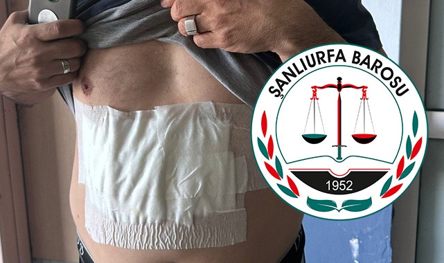 Akçakale'de sandık görevlisine saldırı iddiası!