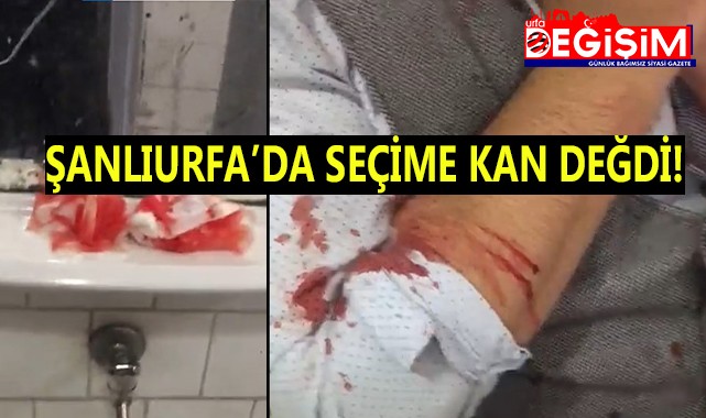 Şanlıurfa'da kanlı seçim!