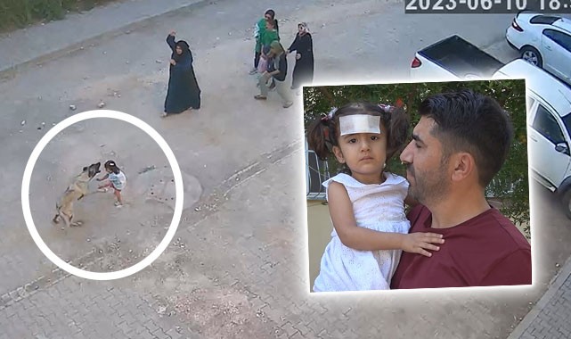 Urfa'da köpek saldırısına uğrayan çocuk taburcu edildi