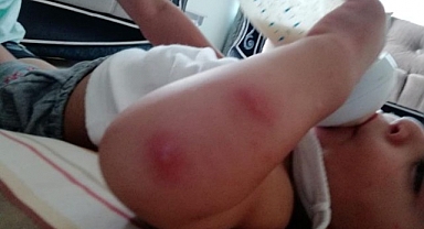 Viranşehir’de ilaçlandırma yapılmıyor mu?
