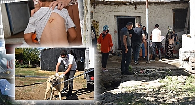 Şanlıurfa'da 3 çocuk köpek saldırısına uğradı!