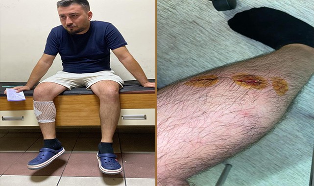 Sokak köpekleri gence saldırıp bacağından ısırdı
