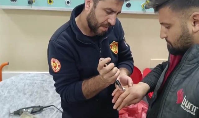 Parmağına yüzük sıkıştı! İtfaiye ekipleri kurtardı