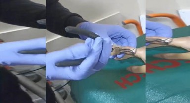 Parmağına yüzük sıkıştı! İtfaiye çıkardı