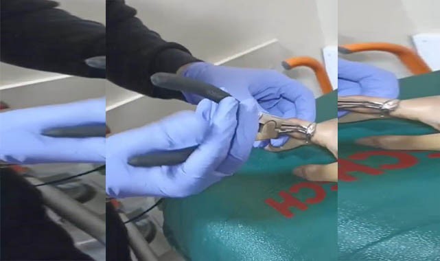 Parmağına yüzük sıkıştı! İtfaiye çıkardı