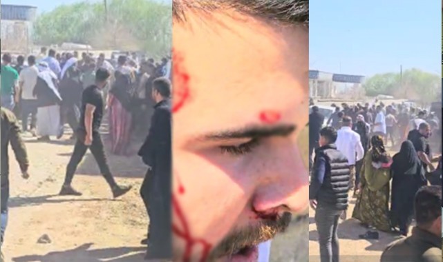 Şanlıurfa'da muhtarlık kavgası! 6 yaralı