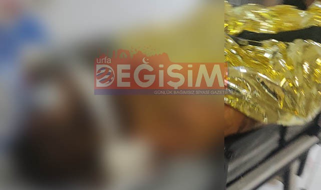 Mardin’deki anız yangınında ağır yaralanan 2 kişi Urfa’ya getirildi