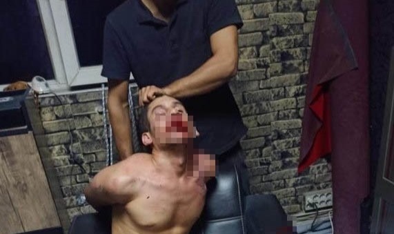 Dişleri sökülüp, hamamböceği yedirilip günlerce işkence gören Suruçlu genç yaşadıklarını anlattı!