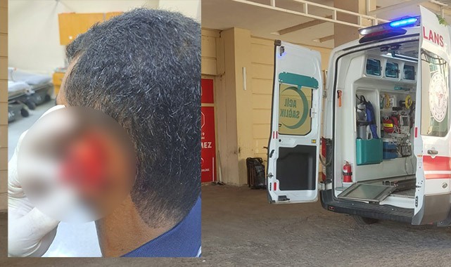 Şanlıurfa'da kavga! Kardeşinin kulağını ısırarak kopardı