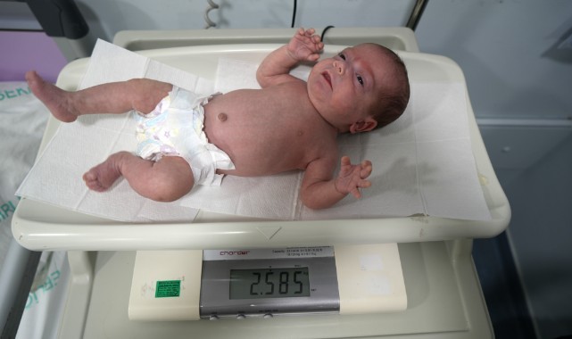 28 Haftalık bebek hayata tutundu