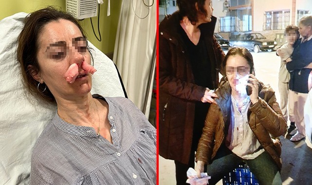 Kocasının sevgilisine benzettiği kadını dövdü! Pardon deyip kaçtı