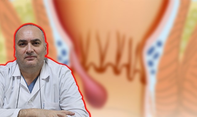 Uzmanından hemoroid uyarısı: "Kanama sebebi mutlaka araştırılmalı"