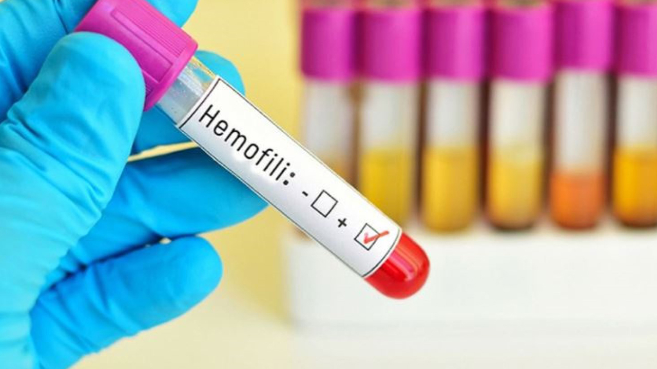 Hemofili A için evde uygulanan ilaç geri ödemeye alındı!