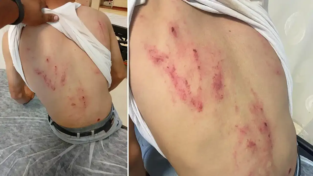 Şanlıurfa’da ŞUSKİ personeline köpekli saldırı! Yüksek fatura…