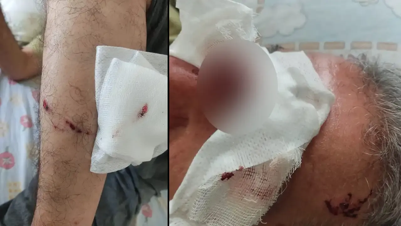 Şanlıurfa’da sokak köpekleri iki sporcuyu parçaladı
