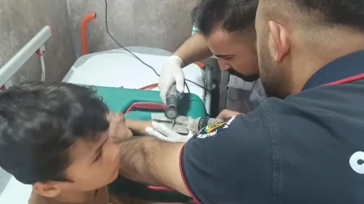 Şanlıurfa’da çocuğun parmağına sıkışan cıvata pulu itfaiye tarafından çıkartıldı