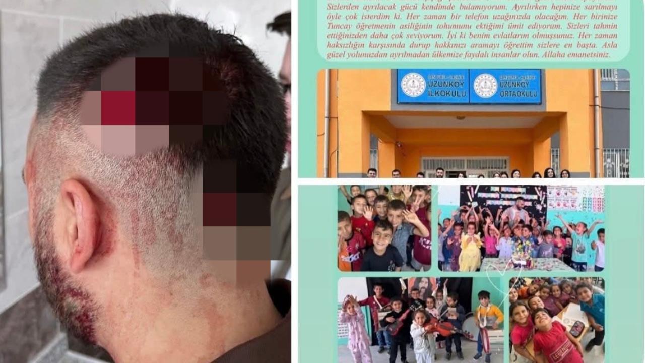 Şanlıurfa’da Öğretmene Saldırı İddiası: “Yıllardır Emek Verdiğim Yuvamdan Kanlar İçinde Ayrılıyorum”
