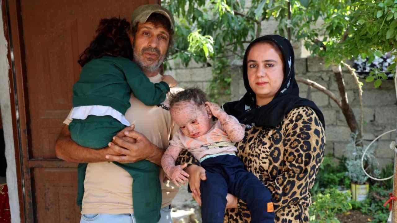 Şanlıurfa’da Yusuf için toplanan yardımlar dolandırıcıların cebine gitti
