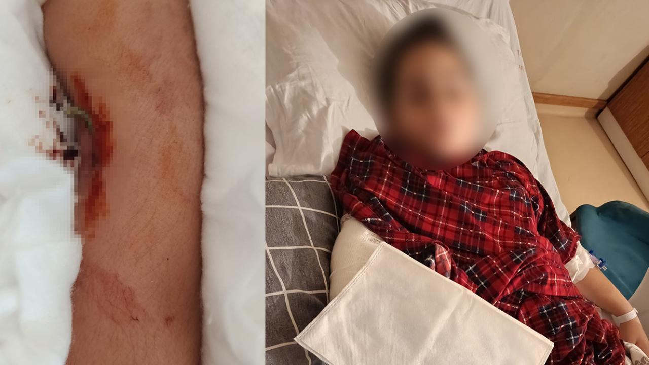 Okulda akran zorbalığı: 9 yaşındaki çocuk arkadaşının kolunu iki yerinden kırdı!