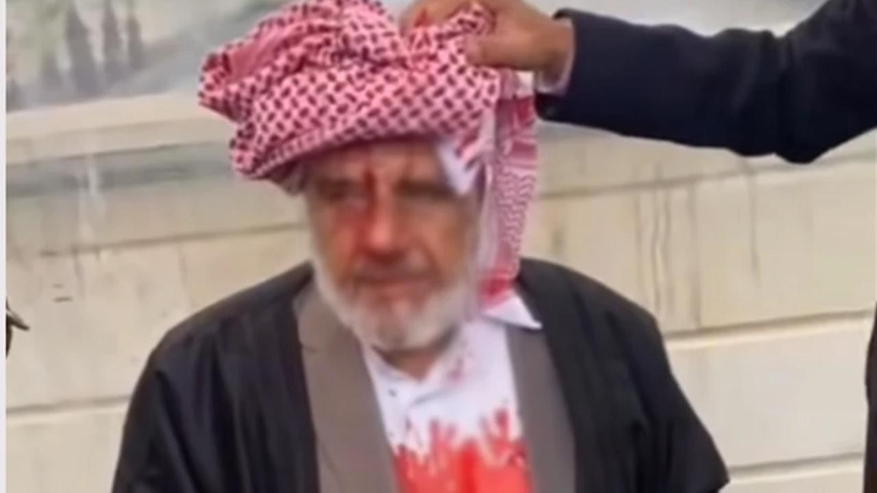 Viranşehir’de cami çıkışı saldırı: 71 yaşındaki adam hastanelik oldu