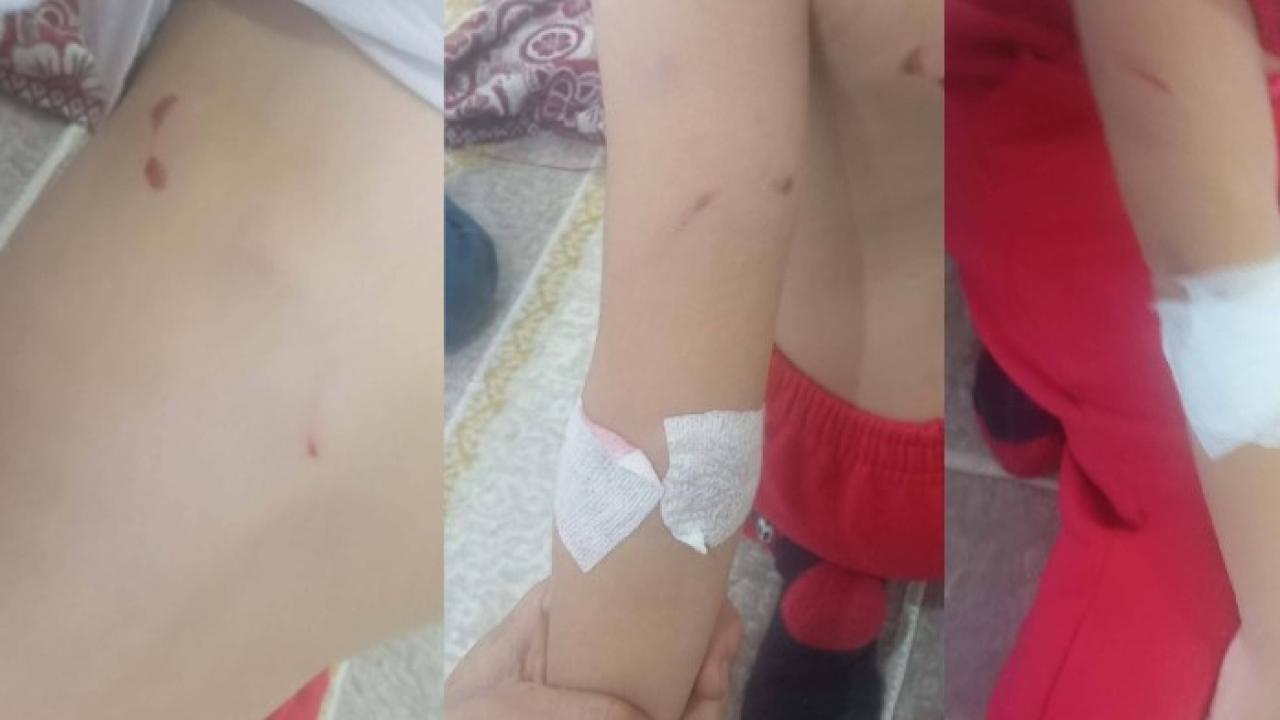 Şanlıurfa’da sokak köpekleri küçük kıza dehşet yaşattı