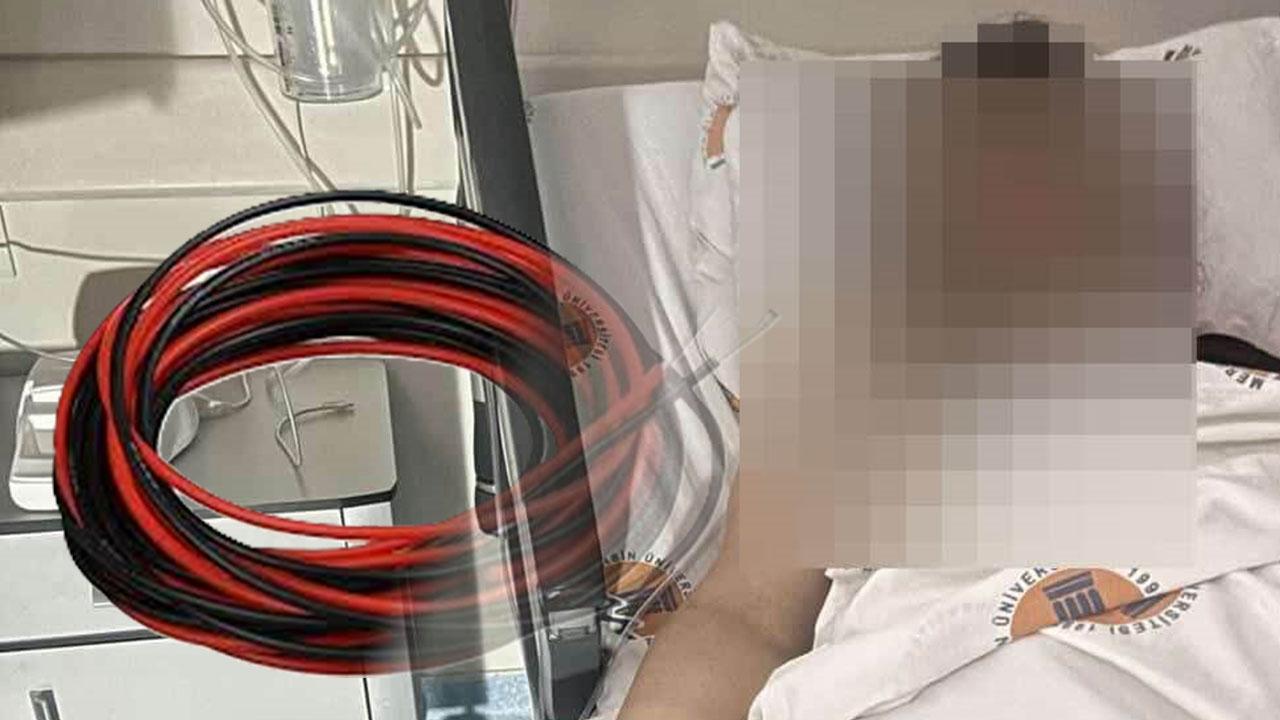 Eski sevgili dehşeti: Önce kabloyla boğmaya çalıştı, ardından defalarca bıçakladı