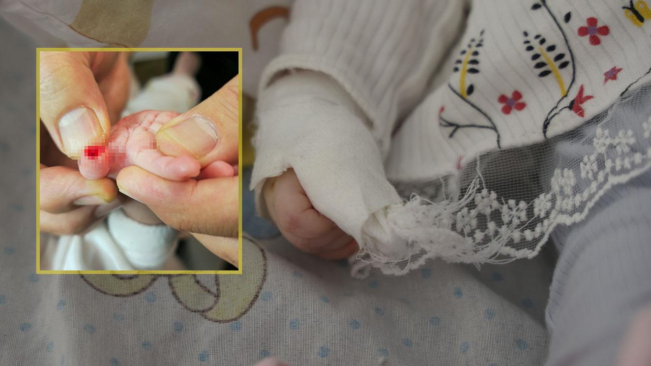 Hatay’da hastanede skandal iddia: 5 aylık bebeğin parmağı ke