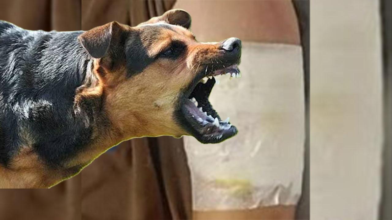 Şanlıurfa'da köpek saldırısı: 6 yaşındaki çocuk hastanelik oldu