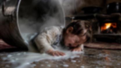 Suruç'ta feci olay: Kaynar sütün içine düşen çocuk ağır yaralandı